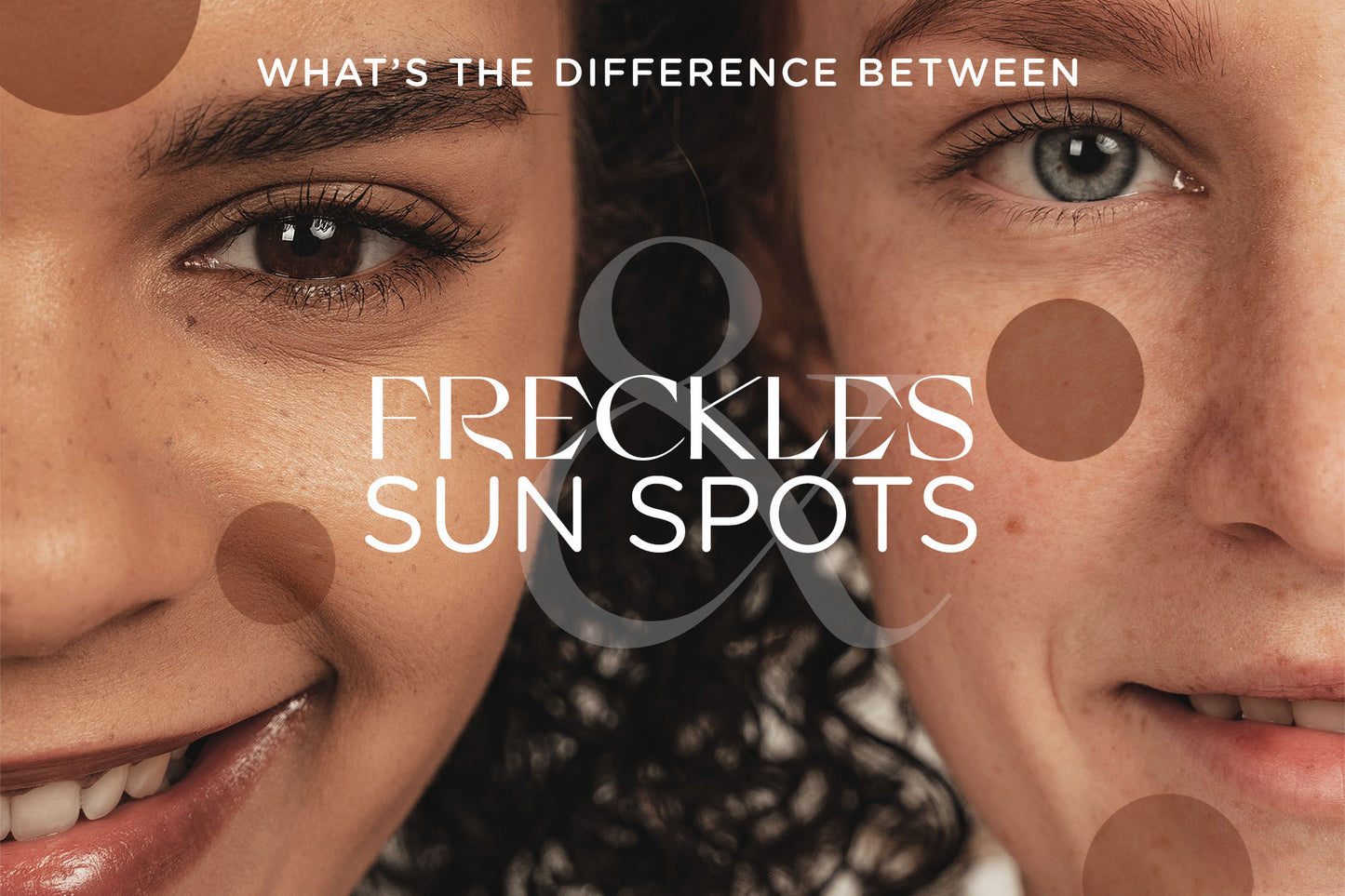 The difference between freckles and sun spots